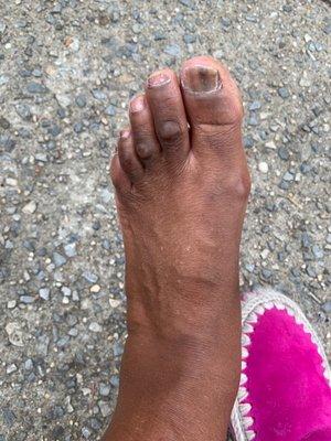 Very unprofessionally done waste my money