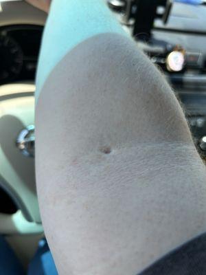 Talecris Plasma Resources