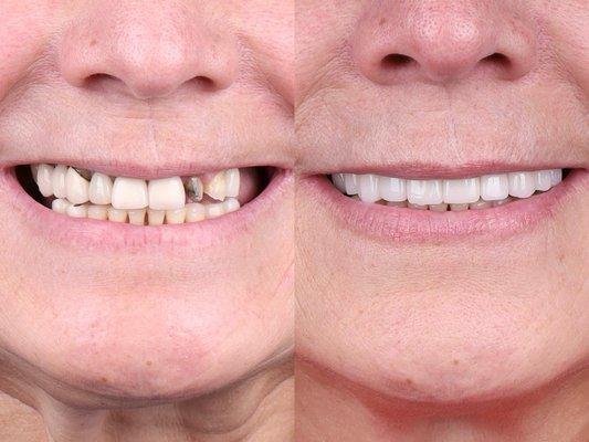 Neglect reversed. Confidence restored.