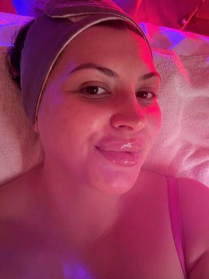 Hydrafacial by Vinny