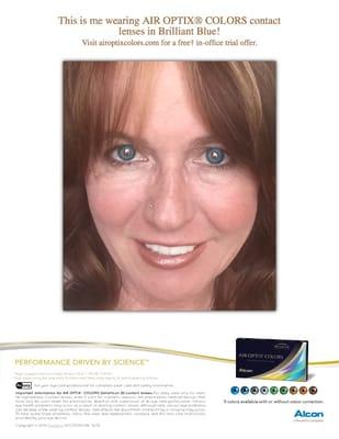 My eyes are naturally dark brown. Dr. Mead assisted in changing them to blue!