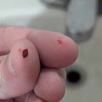 A bed bug during an infestation in my room.