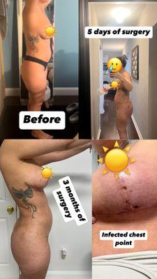 Balto Plastic Surgery