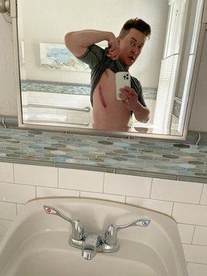 Hit and luckily grabbed the arm railing