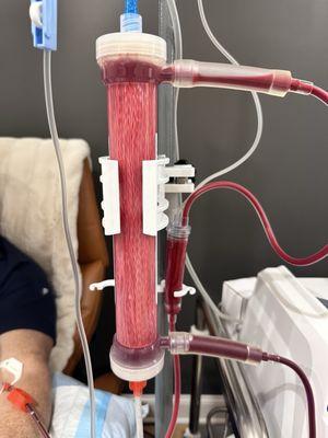 Filter removing unwanted junk from your body.