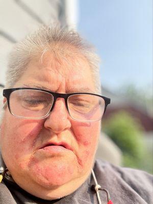 Voyage Healthcare - Crystal