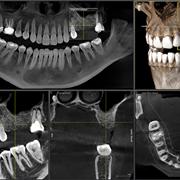 Brodhagen Dental Care