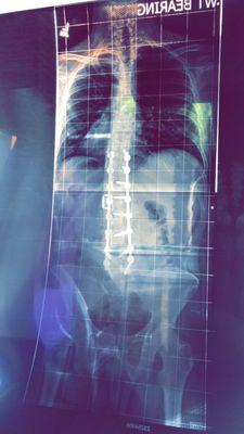 Rafath Baig, MD - Desert Spine And Scoliosis Center