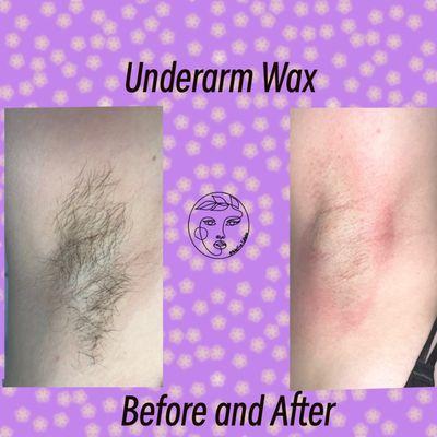 Before and after underarm wax