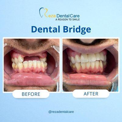 Reza Dental Care