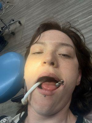 Left with mouth propped open for 25 minutes