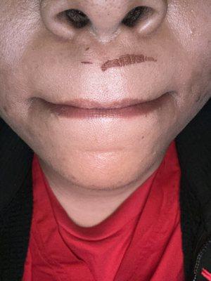 Top lip from upper lip wax