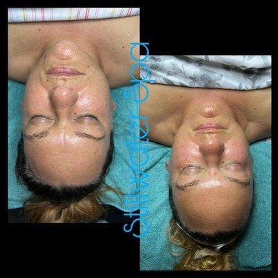 Before and after a month on Circadia skin care routine!