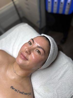 Premium Hydrafacial