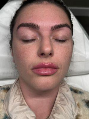 Client requested a Half Set: Before