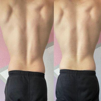 back more defined and more curves! amazing results!Thank you for happy kind feedbacks