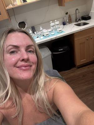 Jen has helped me so much with my dry skin and redness. It's getting better every week!