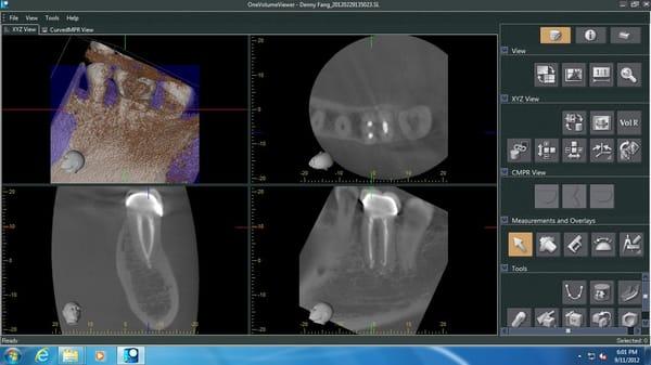 Prestige Endodontics