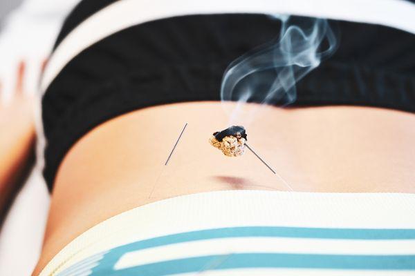 Derek Flores-Lefranc, LAc