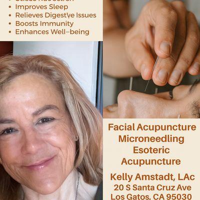 Sonrisa Acupuncture