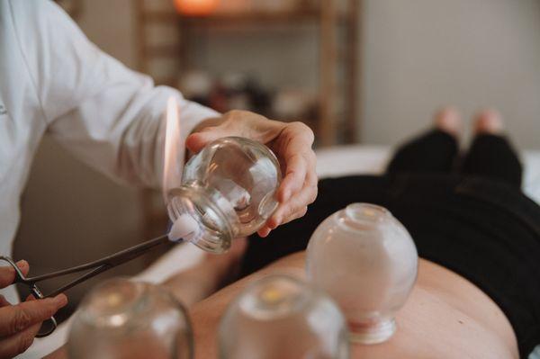 Everyone's favorite! Chinese fire cupping.