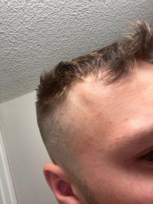 Pushed my hairline all the way the back. what a joke