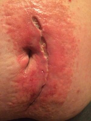 Nicholson George B Jr MD