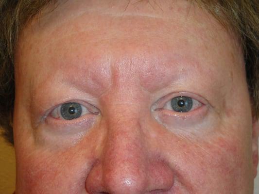 Another You Permanent Cosmetics