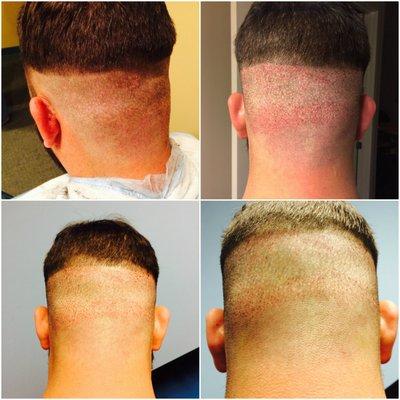 Before and After #23