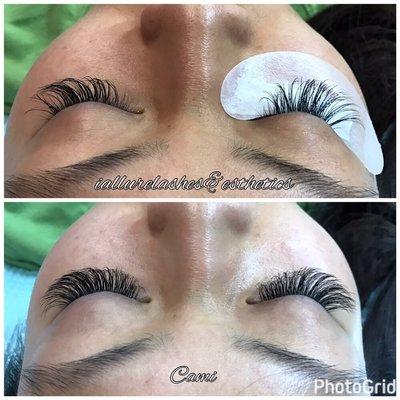 Before and after 4 wk Fill