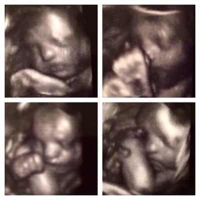 My handsome son that I have seen over and over & get 2 look back @ these amazing beautiful pictures all because of Baby Preview!