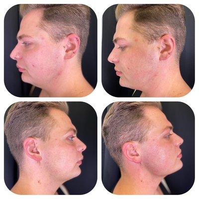 Esthebella Skin
