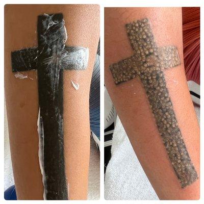 first tattoo removed session with laser.