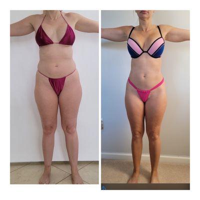 New Radiance Cosmetic Centers - Wellington