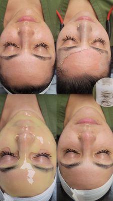 Eleven Eleven Esthetics