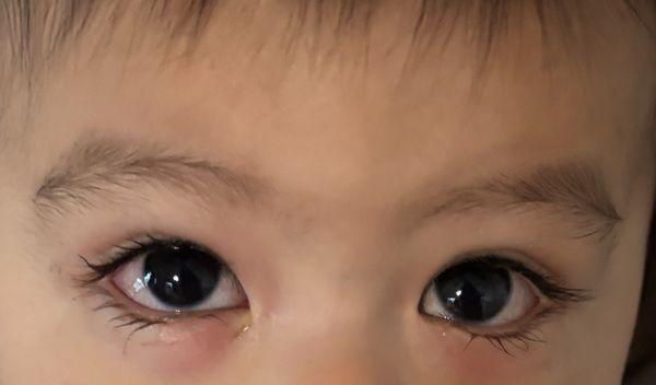 America's Best Contacts & Eyeglasses