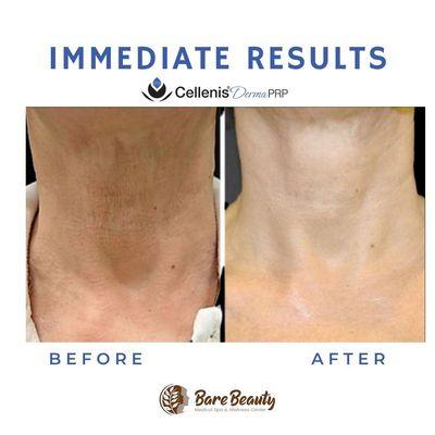 Bare Beauty Medical Spa & Wellness Center