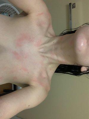 what I get every time I want to shower!!