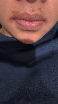 again, BE CAREFUL getting waxed