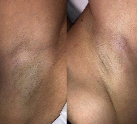 First and last session!!