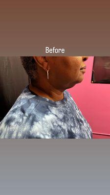 LaSculpt BodySculpting Spa