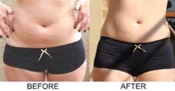 Elite Face & Body Contours