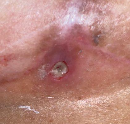 Eades Plastic Surgery