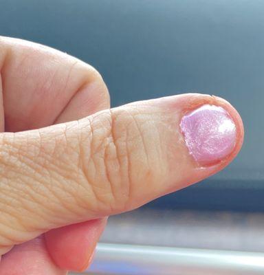 Messy & globby polish application.