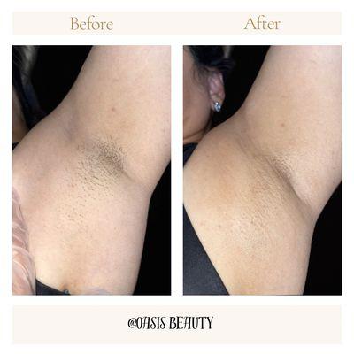 Underarm wax, nice and smooth