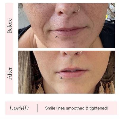 Meg & Co. Medical Aesthetics & Laser