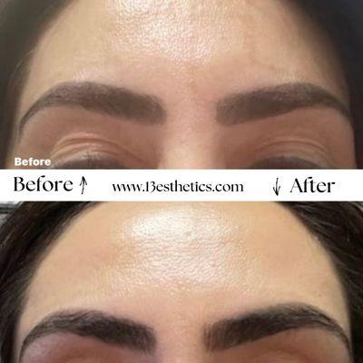 Advanced Firm & Lift Facial + Collagen Mask - 6 Treatments