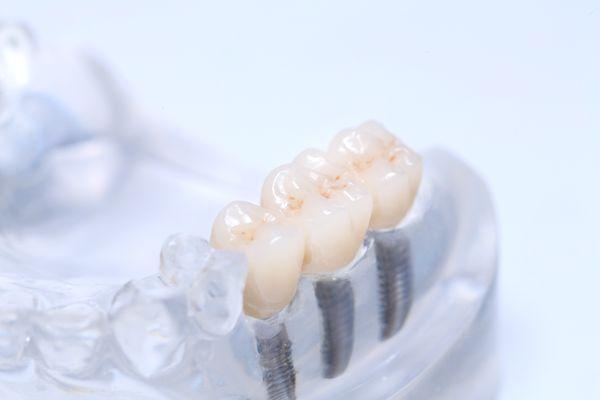 Resilient Smile Dental Lab