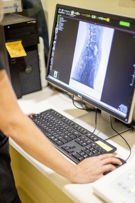 We perform X-Rays ON SITE! Don't hesitate to come in TODAY for X-Ray evaluation!