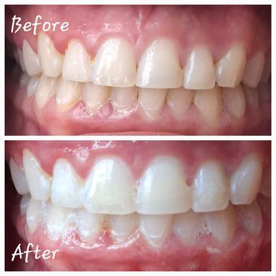 Beautiful before and after.